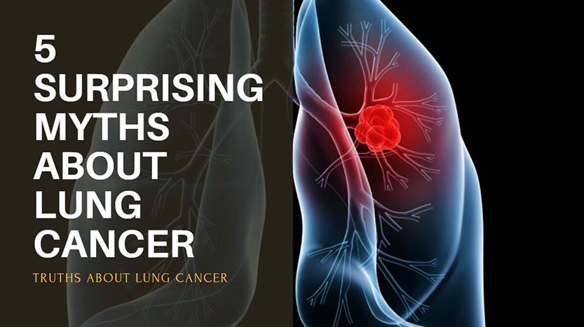 5 Myths About Lung Cancer