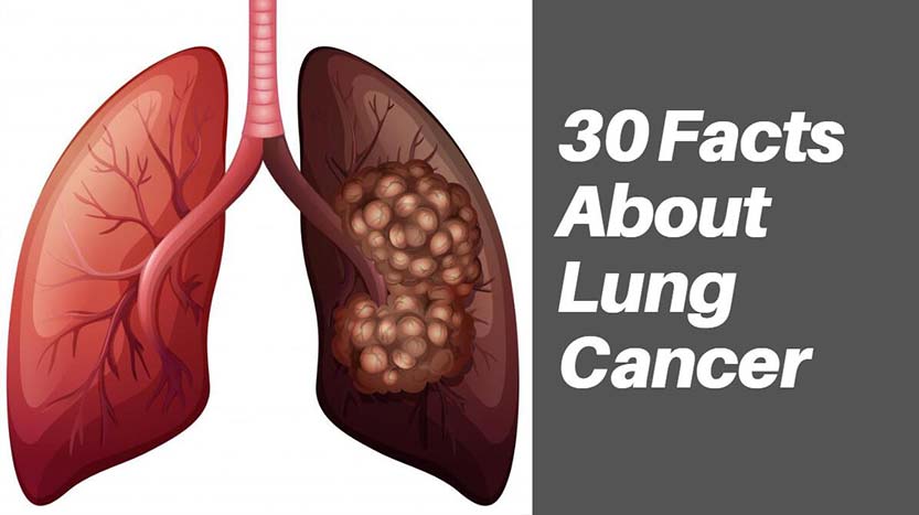 30 Facts About Lung Cancer