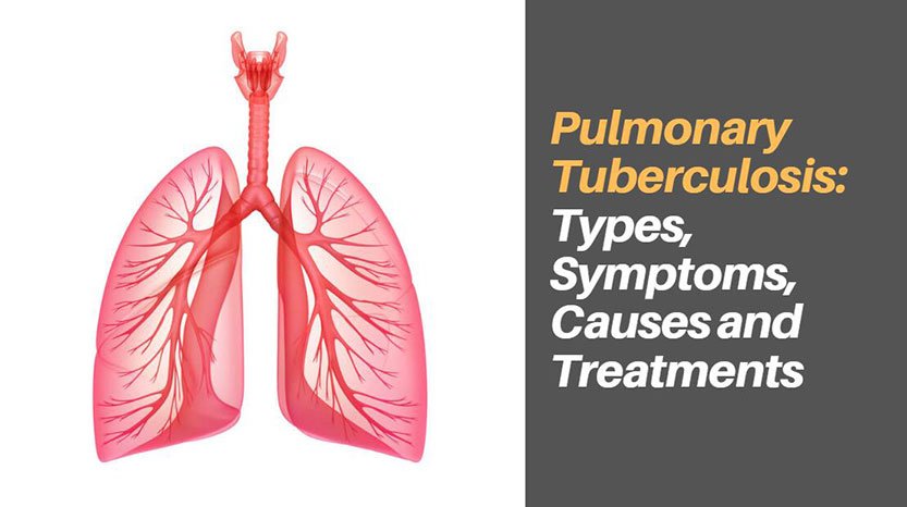 Pulmonary Tuberculosis: Types, Symptoms, Causes and Treatments