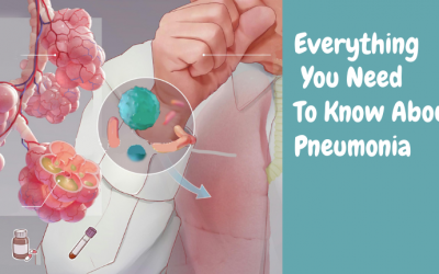 Everything You Need Know About Pneumonia