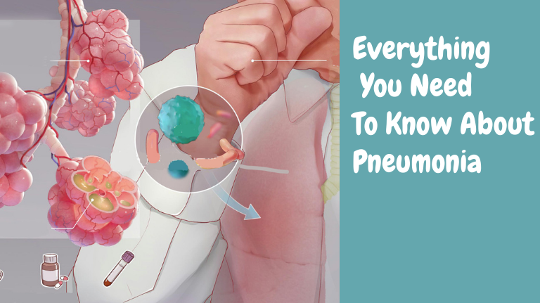 Everything You Need Know About Pneumonia