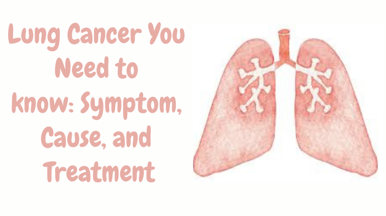 lung-cancer-symptoms-cause-classfications