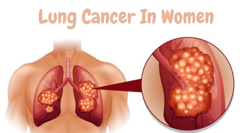 Lung Cancer In Women