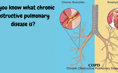Do you know what chronic obstructive pulmonary disease is?