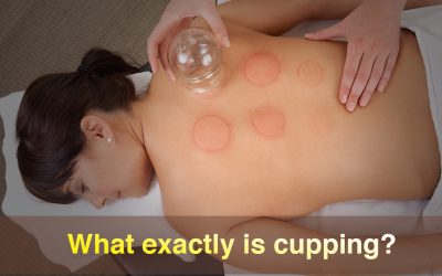 What Exactly is Cupping?